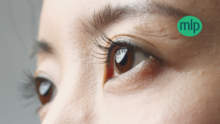 When Eye Treatment Goes Wrong: Understanding Your Rights to Compensation After Eye Injury Negligence