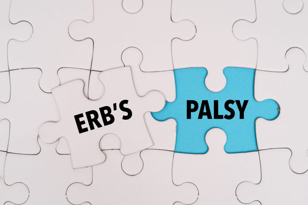 erbs-palsy